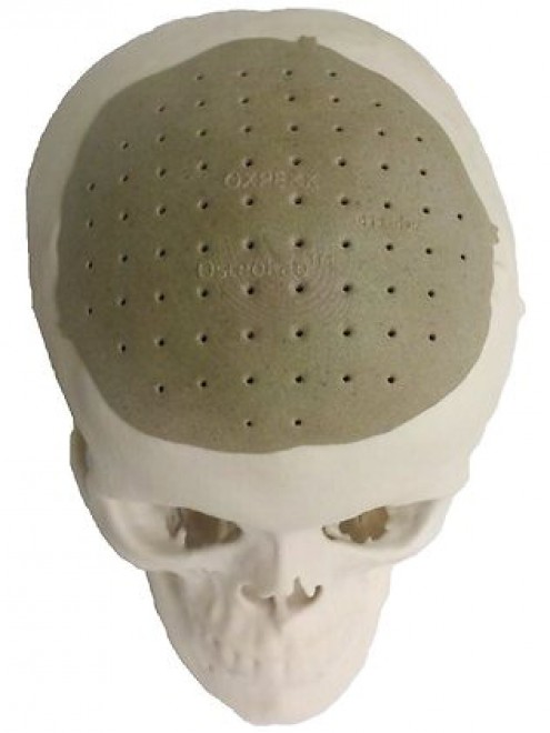 Il cranio umano si stampa in 3D