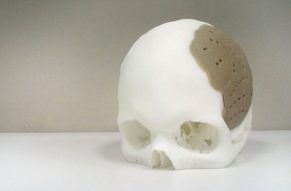 Il cranio umano si stampa in 3D