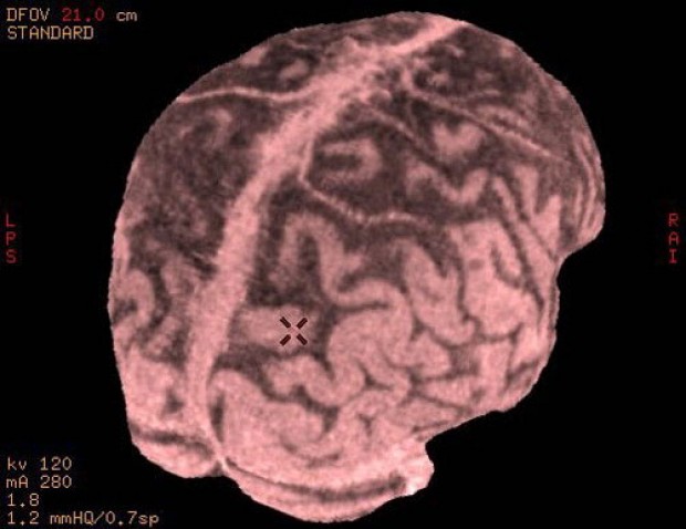 Ma il cervello batte sempre il supercomputer